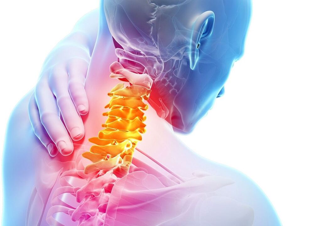 localization of osteoarthritis